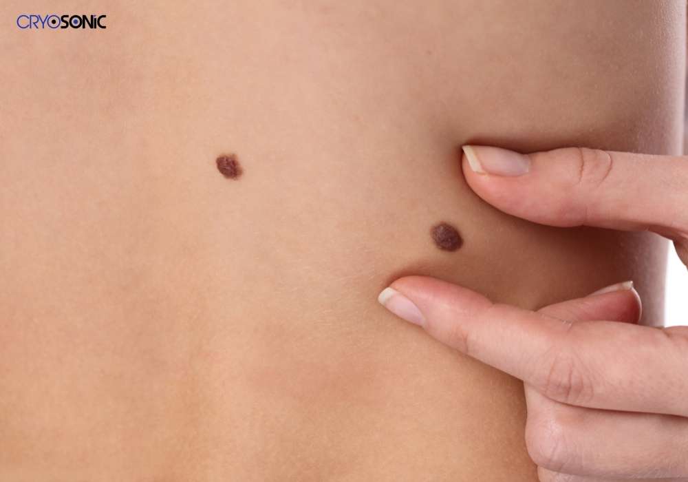 Infection Risk and Poor Aftercare Stockport