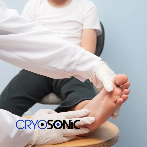 Are you looking for fast effective wart removal Contact us today Stockport