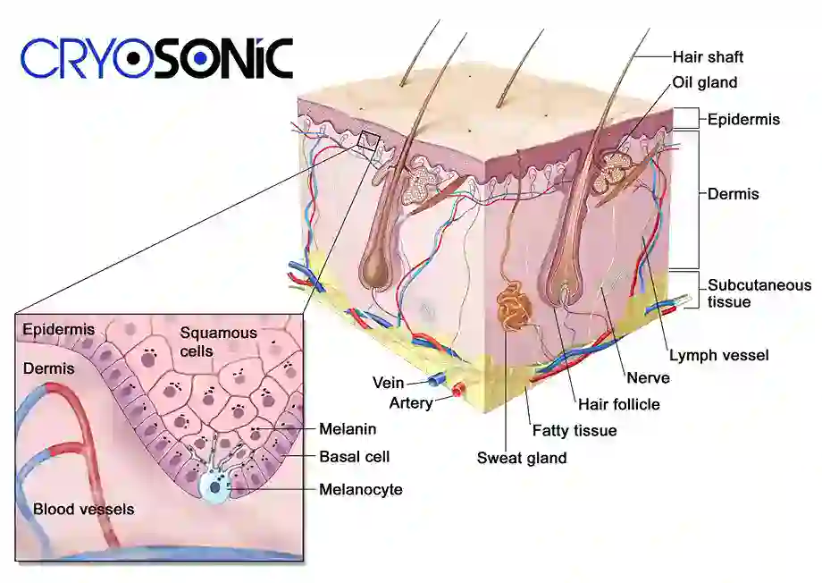 How Cryotherapy Stimulates Melanocyte Activity  Stockport